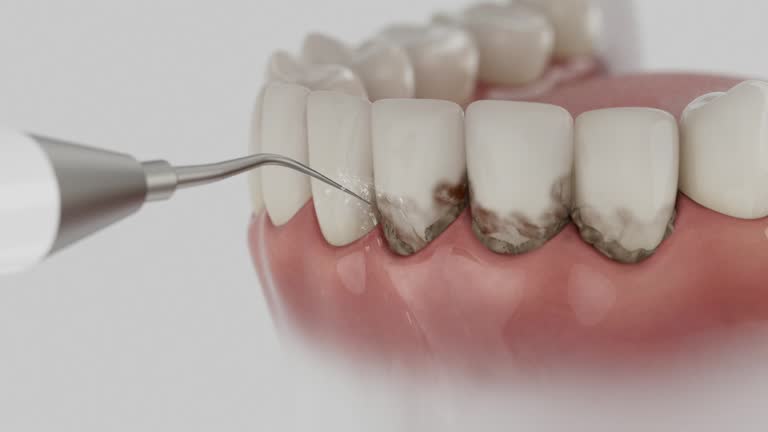 Trusted Tooth Extraction service in North Kansas City, MO - Dentist Open Now